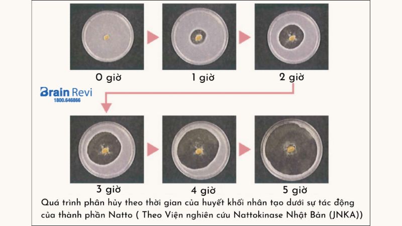 Nattokinase có tác dụng phá tan huyết khối