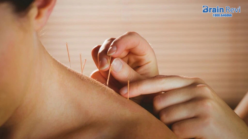 Châm cứu giúp giải phóng các chất thúc đẩy giấc ngủ