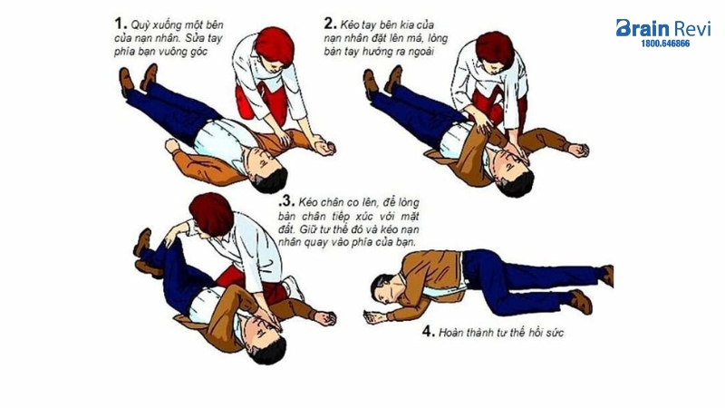 Xử trí đột quỵ não
