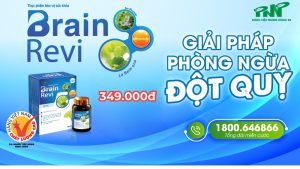 Đau nửa đầu bên trái- Nguyên nhân và cách điều trị